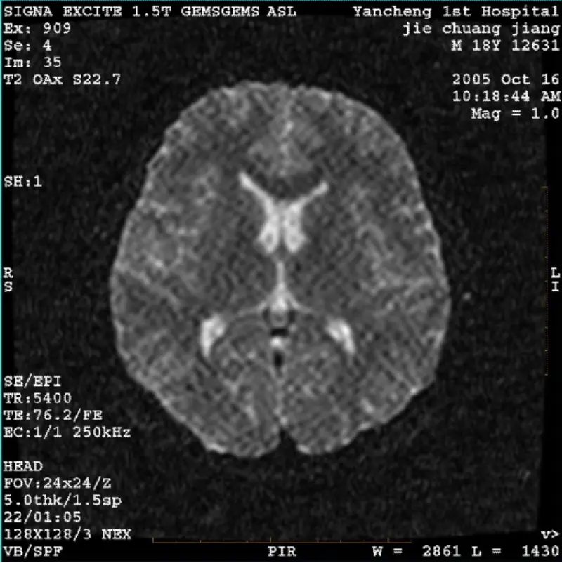 ARTIFACT WI/Fiesta Image Pixel White